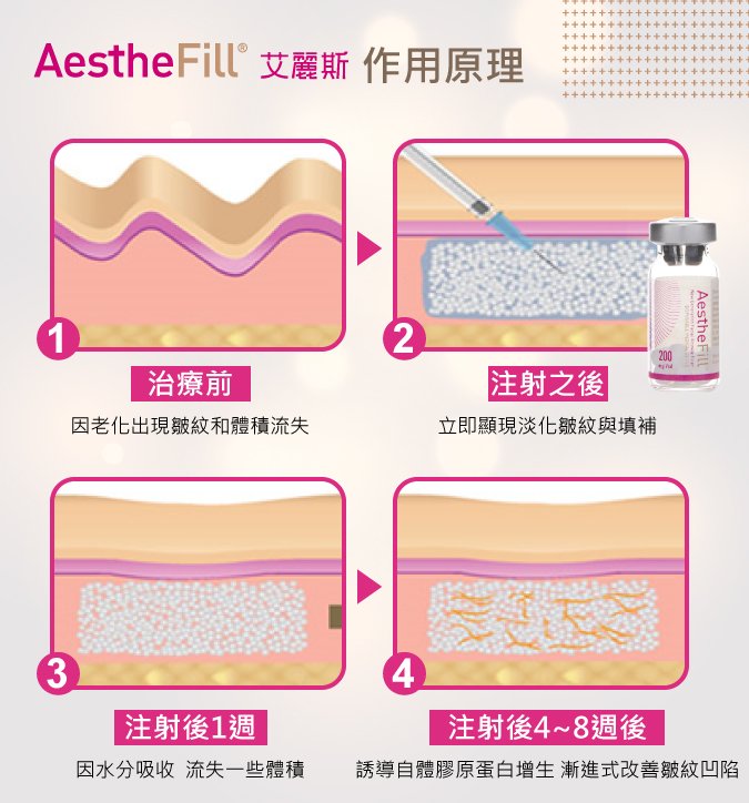 AESTHEFILL(艾丽斯精灵针)