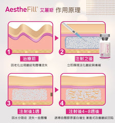 AESTHEFILL(艾丽斯精灵针)