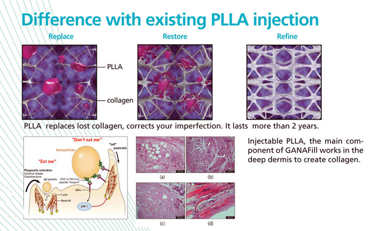 GANA FILL PLLA X 身體套裝